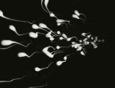 SpermatozoidEncre.jpg